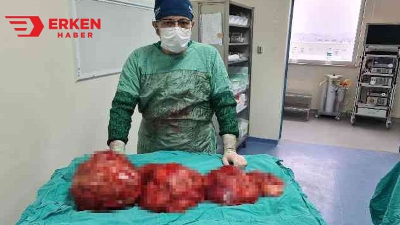 Hastanın Karnından 13 kilogram kitle çıktı