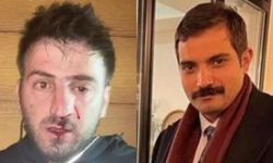 Dodo'yu Gürcistan'a kaçırdığı öne sürülen MHP'li konuştu