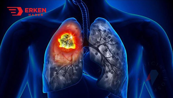akciğer kanseri1